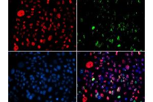 Immunofluorescence (IF) image for anti-Structural Maintenance of Chromosomes 1A (SMC1A) (pSer957) antibody (ABIN3019554) (SMC1A antibody  (pSer957))