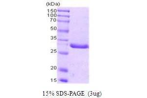 Figure annotation denotes ug of protein loaded and % gel used. (PCNA Protein (AA 1-261))