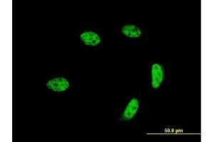 Immunofluorescence of monoclonal antibody to GTF2A1L on HeLa cell. (GTF2A1L antibody  (AA 251-348))