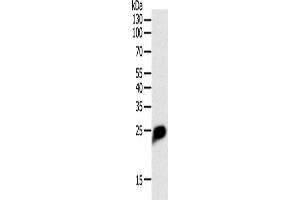 Western Blotting (WB) image for anti-C-Reactive Protein (CRP) antibody (ABIN2421439) (CRP antibody)