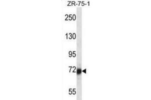 Western Blotting (WB) image for anti-SP100 Nuclear Antigen (SP100) antibody (ABIN2998211)