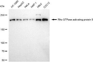 Western blotting analysis using Rho GTPase activating protein 5 antibody (ABIN7800199). (Recombinant ARHGAP5 antibody)