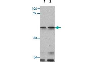 Western blot analysis of GLS2 in rat kidney tissue lysate with GLS2 polyclonal antibody  at 0. (GLS2 antibody  (Internal Region))