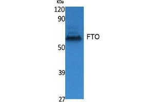 Western Blotting (WB) image for anti-Fat Mass and Obesity-Associated (FTO) (N-Term) antibody (ABIN3187602) (FTO antibody  (N-Term))