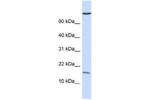 GABARAP antibody used at 1 ug/ml to detect target protein. (GABARAP antibody)