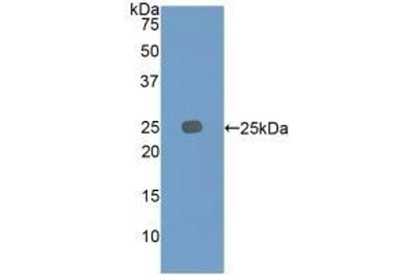 IGFBP7 antibody  (AA 88-281)