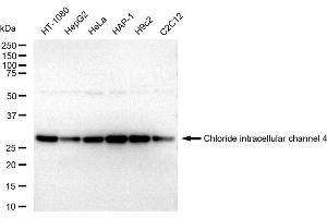 Western blotting analysis using Chloride intracellular channel 4 antibody (ABIN7798051).
