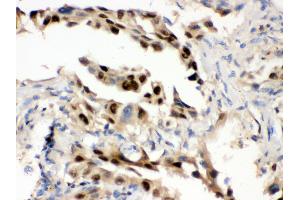Immunohistochemistry (Paraffin-embedded Sections) (IHC (p)) image for anti-Heat Shock 70kDa Protein 1A (HSPA1A) (AA 559-596), (C-Term) antibody (ABIN3043849)