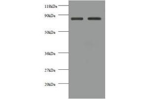 Western blot All lanes: CDH12 antibody at 2 μg/mL Lane 1: EC109 whole cell lysate Lane 2: 293T whole cell lysate Secondary Goat polyclonal to rabbit IgG at 1/10000 dilution Predicted band size: 89, 85 kDa Observed band size: 85 kDa (Cadherin 12 antibody  (AA 56-605))