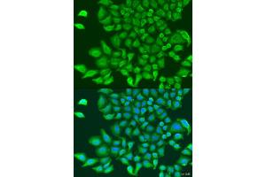 Immunofluorescence analysis of U2OS cells using TUBGCP3 antibody (ABIN1875232) at dilution of 1:100. (TUBGCP3 antibody)