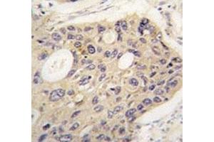 Immunohistochemistry (IHC) image for anti-Autophagy Related 12 (ATG12) antibody (ABIN3028485)