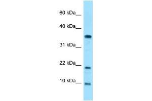 Western Blotting (WB) image for anti-Small Nuclear Ribonucleoprotein Polypeptide E (SNRPE) (N-Term) antibody (ABIN2789399)