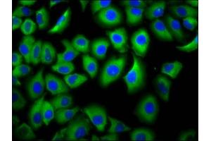 Immunofluorescence staining of A549 cells with ABIN7158551 at 1:66, counter-stained with DAPI. (FCGR3B antibody  (AA 18-125))