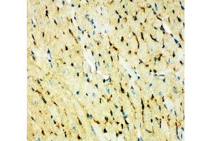 IHC-P: FABP5 antibody testing of mouse heart (FABP5 antibody  (AA 10-23))