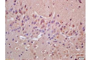 Formalin-fixed and paraffin embedded rat brain labeled with Anti-VAV3 Polyclonal Antibody, Unconjugated (ABIN706421) at 1:200 followed by conjugation to the secondary antibody and DAB staining (VAV3 antibody  (AA 701-800))