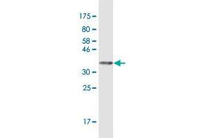 Western Blot detection against Immunogen (38. (TLR5 antibody  (AA 517-634))