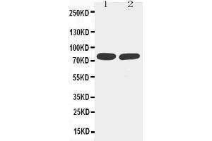 Anti-TNF Receptor II antibody, Western blotting Lane 1: MM453 Cell Lysate Lane 2: JURKAT Cell Lysate (TNFRSF1B antibody  (Middle Region))