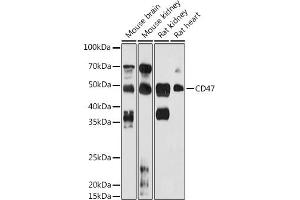 Western blot analysis of extracts of various cell lines, using CD47 antibody (ABIN6127604, ABIN6138199, ABIN6138201 and ABIN6223104) at 1:1000 dilution. (CD47 antibody  (AA 20-140))