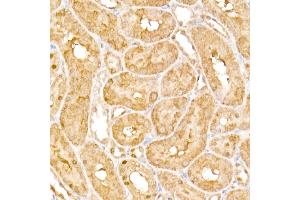 Immunohistochemistry (IHC) image for anti-Adaptor-Related Protein Complex 3, beta 1 Subunit (AP3B1) (AA 895-1094) antibody (ABIN6136962)
