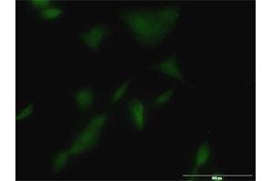 Immunofluorescence of monoclonal antibody to KLK3 on A-549 cell. (Prostate Specific Antigen antibody  (AA 1-261))
