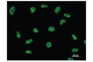 Immunostaining analysis in HeLa cells. (DDX39 antibody)