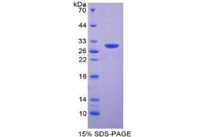 SDS-PAGE (SDS) image for MOK Protein Kinase (MOK) (AA 2-228) protein (His tag) (ABIN1878678) (MOK Protein (AA 2-228) (His tag))