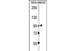 Western blot analysis in MDA-MB435 cell line lysates (15ug/lane).