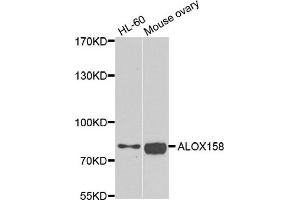 Western blot analysis of extracts of HL60 and mouse ovary cell lines, using ALOX15B antibody. (ALOX15B antibody)