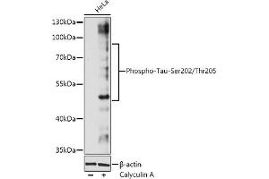Western blot analysis of extracts of Hela cells, using Phospho-Tau-Ser202/Thr205 antibody (ABIN7268525) at 1:1000 dilution. (MAPT antibody  (pSer202, pThr205))