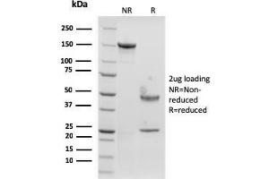 SDS-PAGE Analysis Purified Langerin Recombinant Mouse Monoclonal Antibody (rLGRN/1821). (Recombinant CD207 antibody  (AA 74-213))