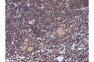Image no. 2 for anti-Monoglyceride Lipase (MGLL) antibody (ABIN1499442) (MGLL antibody)