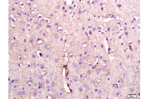 Formalin-fixed and paraffin embedded rat brain labeled with Anti-PMCA Polyclonal Antibody, Unconjugated (ABIN1385852) at 1:200 followed by conjugation to the secondary antibody and DAB staining. (ATP2B2 antibody  (AA 361-460))