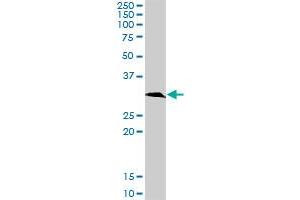 KHK MaxPab rabbit polyclonal antibody. (Ketohexokinase antibody  (AA 1-298))