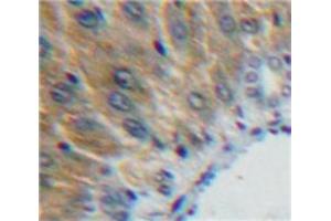 Used in DAB staining on fromalin fixed paraffin-embedded Liver tissue (SHBG antibody  (AA 224-388))