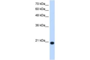 Western Blotting (WB) image for anti-Ubiquitously-Expressed, Prefoldin-Like Chaperone (UXT) antibody (ABIN2463113) (UXT antibody)