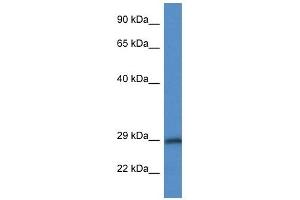 Western Blot showing HPGD antibody used at a concentration of 1 ug/ml against MDA-MB-435S Cell Lysate (HPGD antibody  (N-Term))