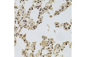 Immunohistochemistry of paraffin-embedded rat lung using FGF2 antibody (ABIN1872685) at dilution of 1:100 (40x lens). (FGF2 antibody)