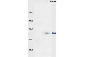 Lane 1: mouse lung lysates Lane 2: mouse intestine lysates probed with Anti DARPP32 Polyclonal Antibody, Unconjugated (ABIN680323) at 1:200 in 4 °C. (DARPP32 antibody  (AA 51-150))