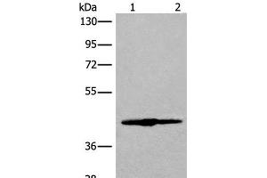 Western blot analysis of 293T cell lysate using IVD Polyclonal Antibody at dilution of 1:500 (IVD antibody)