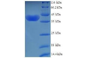 Uridine-Cytidine Kinase 1 (UCK1) (AA 1-201), (Isoform 2) protein (His-SUMO Tag)