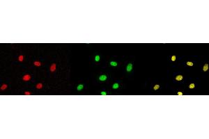 Immunofluorescence (IF) image for anti-Tumor Protein P53 (TP53) (pSer315) antibody (ABIN3201006)