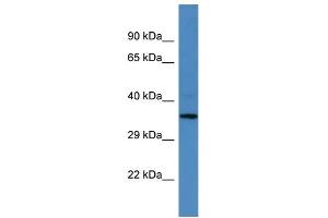 Western Blotting (WB) image for anti-MLF1 Interacting Protein (MLF1IP) (N-Term) antibody (ABIN2788059) (MLF1IP antibody  (N-Term))
