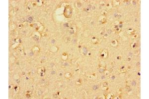 Immunohistochemistry of paraffin-embedded human brain tissue using ABIN7174530 at dilution of 1:100 (UBA6 antibody  (AA 1-44))