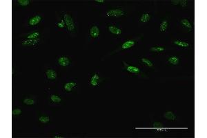 Immunofluorescence of purified MaxPab antibody to LHX4 on HeLa cell. (LHX4 antibody  (AA 1-390))