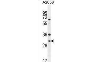 Western Blotting (WB) image for anti-ARV1 Homolog (ARV1) antibody (ABIN2995757)