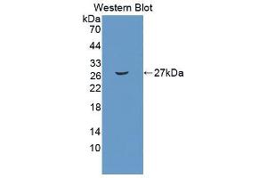 Western blot analysis of the recombinant protein. (PTGDS antibody  (AA 1-199))