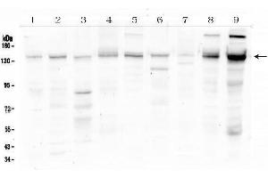 Western blot analysis of HDAC5 using anti-HDAC5 antibody (ABIN6719321). (HDAC5 antibody  (AA 102-197))