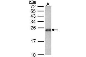 WB Image Sample (30 ug of whole cell lysate) A: Hep G2 , 15% SDS PAGE antibody diluted at 1:1000 (CARHSP1 antibody)