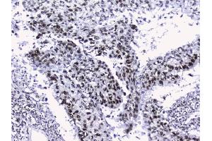 IHC analysis of nmt55/p54nrb using anti-nmt55/p54nrb antibody (ABIN3044530). (NONO antibody  (N-Term))