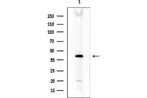 anti-Monoacylglycerol O-Acyltransferase 3 (MOGAT3) (C-Term) antibody